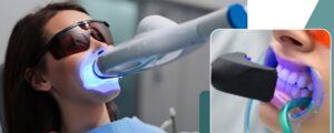 Zoom teeth whitening expert